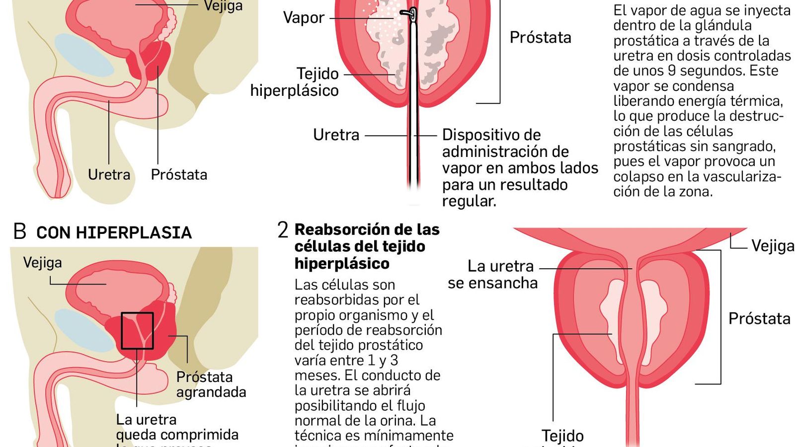 Fuente: Hospital de Valme. Gráfico: Dpto. de Infografía