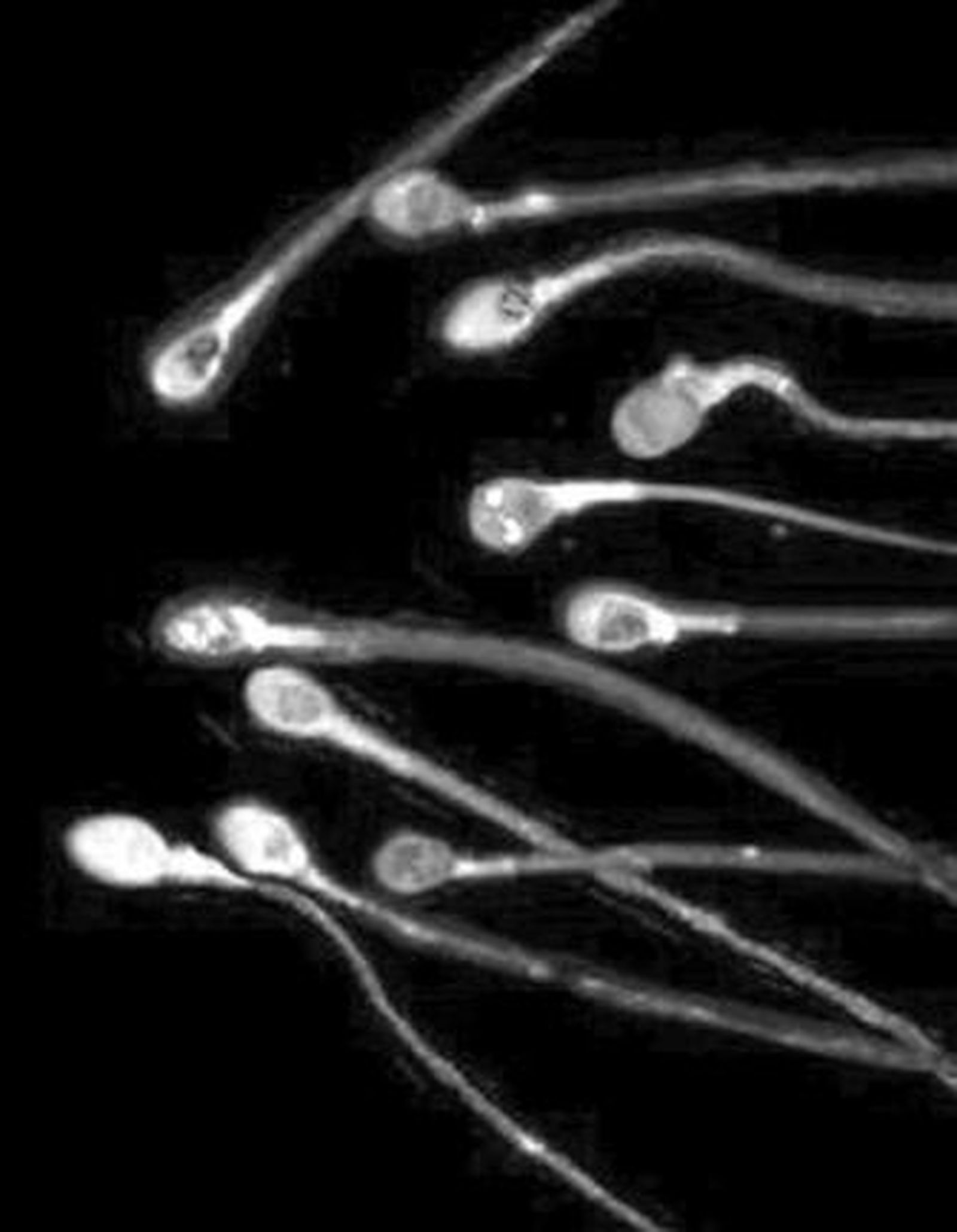 Las técnicas de reproducción asistida son cada vez más precisas y exactas.