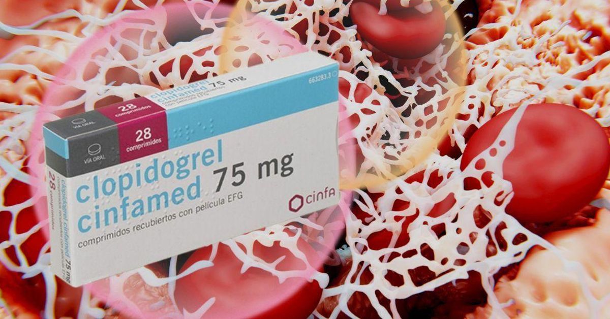 Wie Wirkt Clopidogrel Auf Den Blutdruck www.diariodesevilla.es