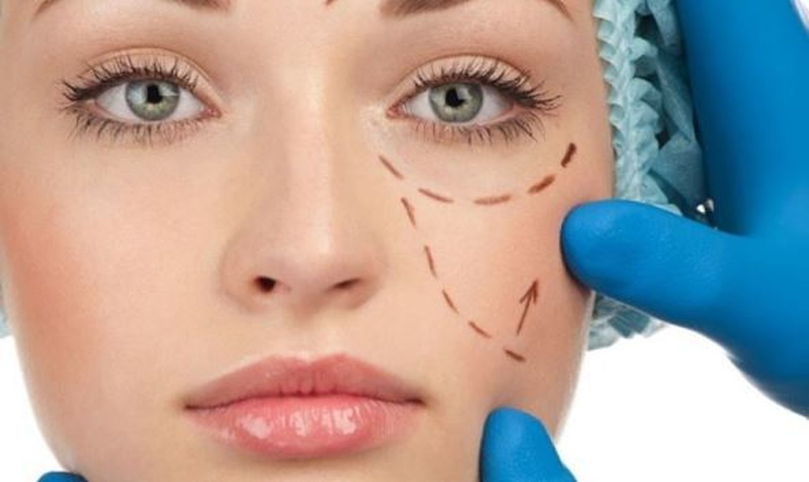 La experiencia de quien va a hacer la operación también es importante.