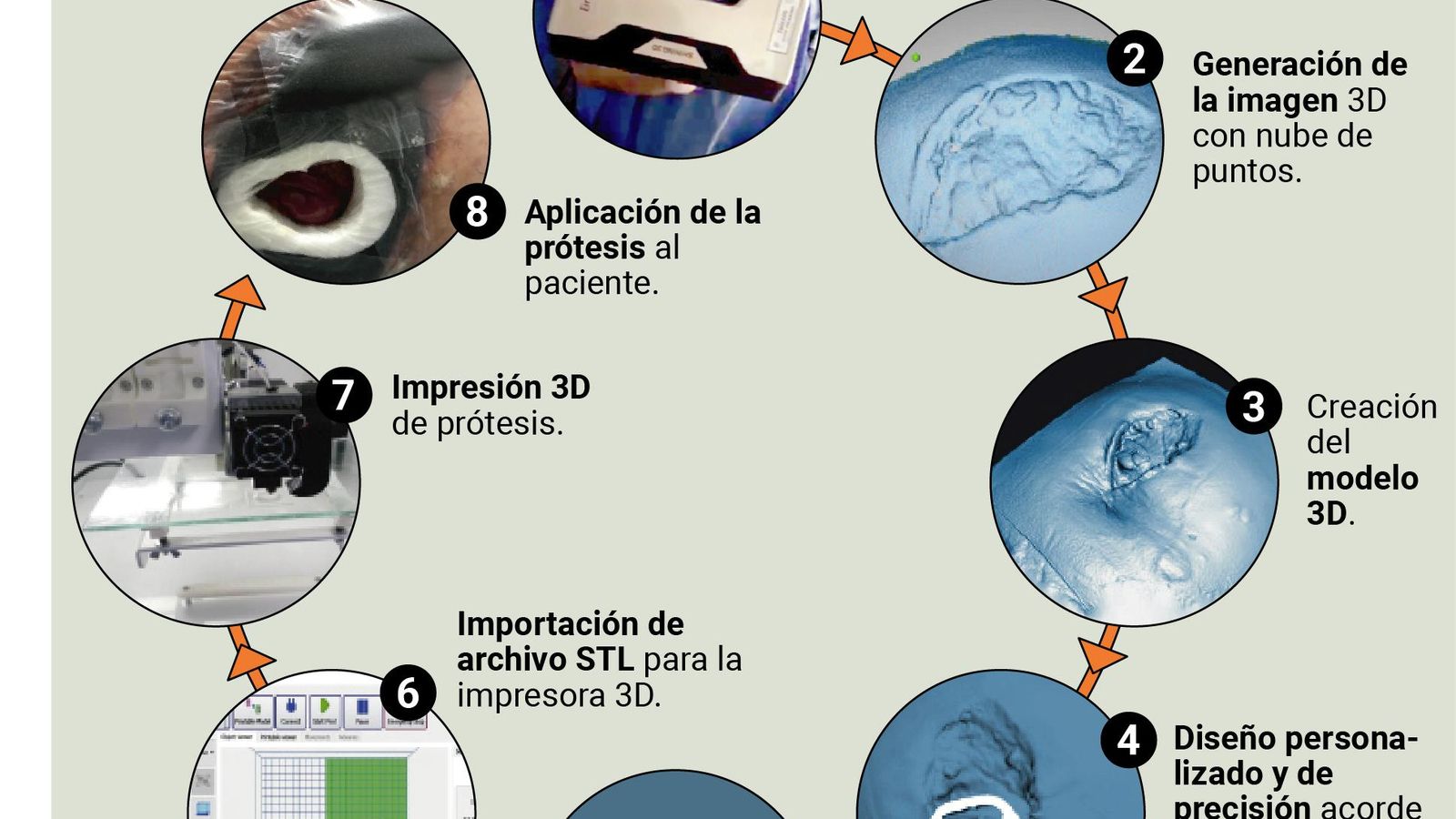 El desarrollo del método Astarfé, paso a paso.