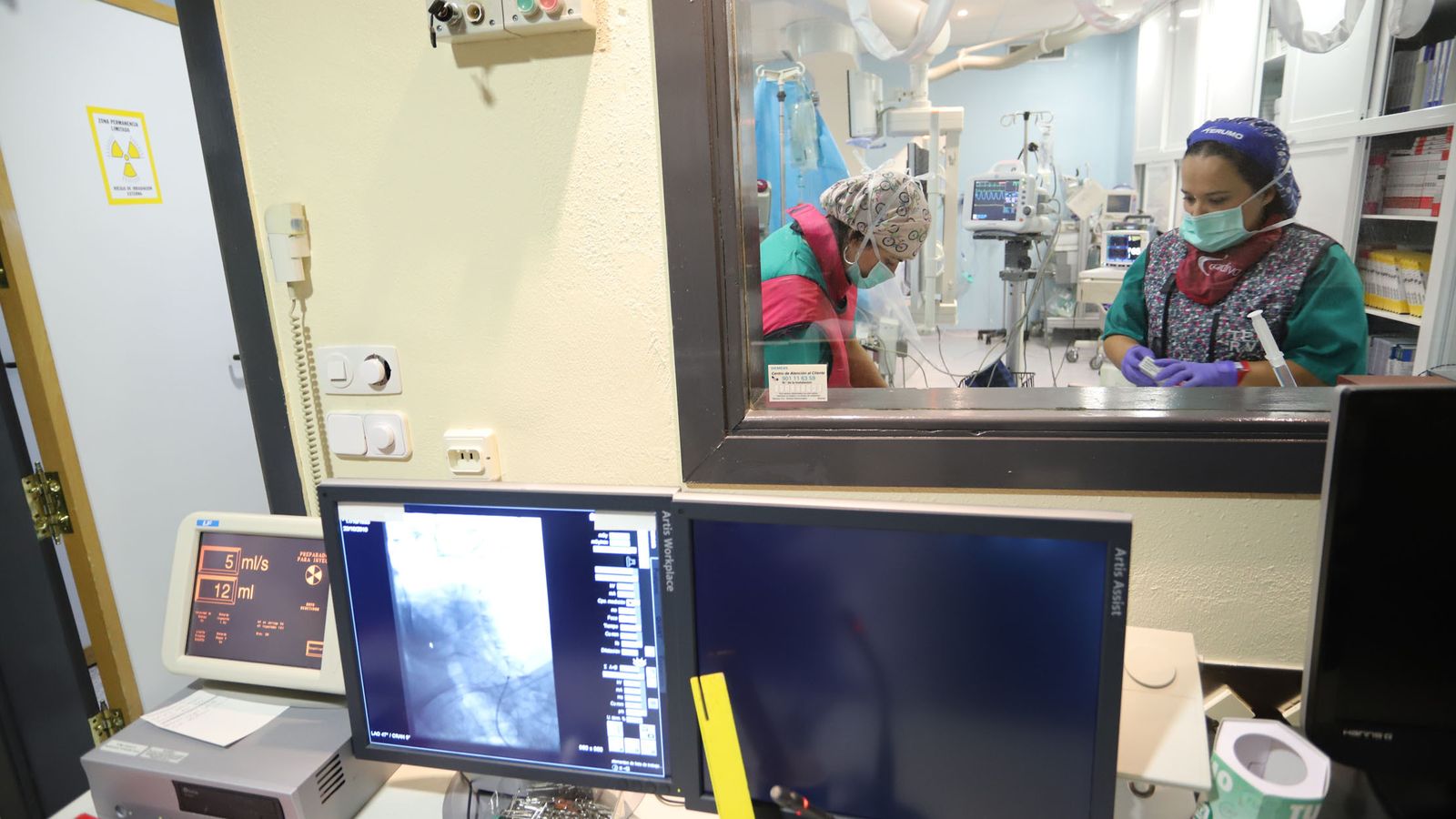 Operación de ictus y prevención del mismo.