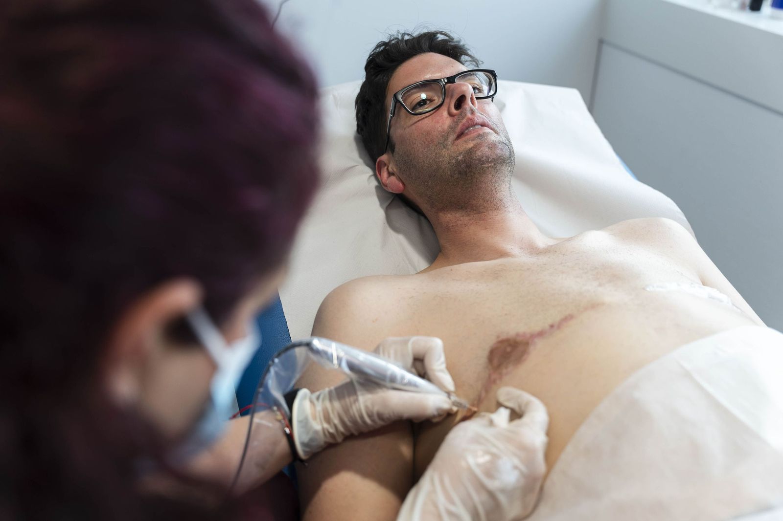 Un tratamiento de micropigmentación por mastectomía en un hombre, en imágenes