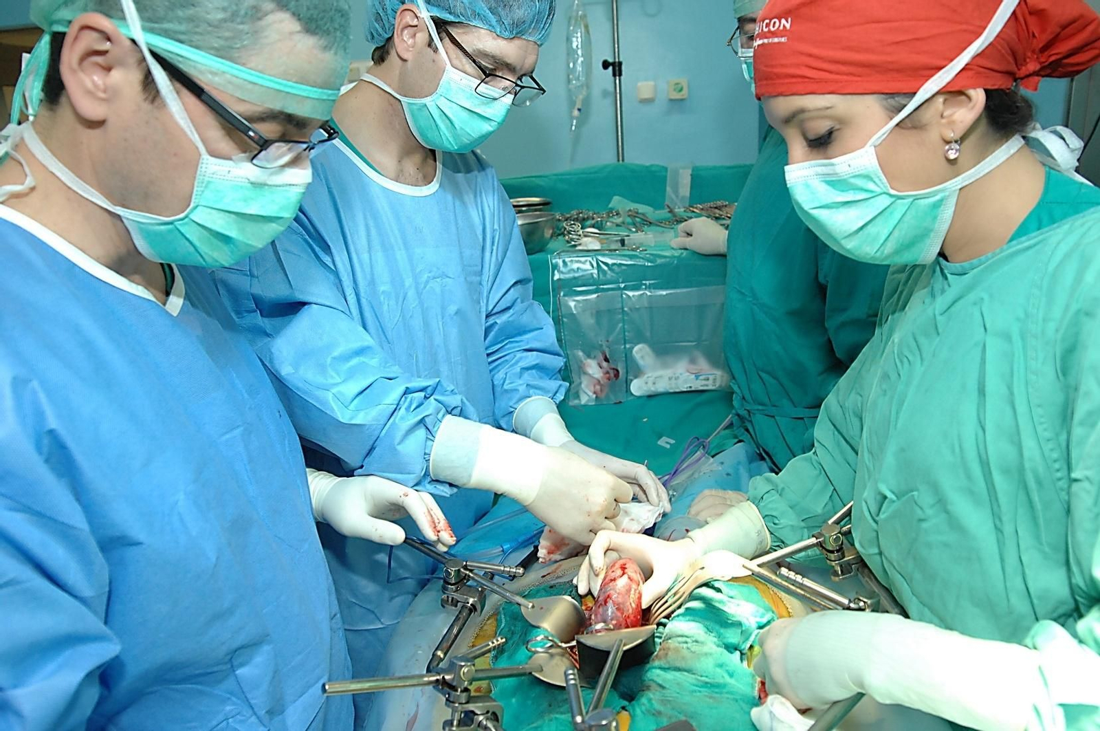 Un equipo médico realiza un trasplante renal. Un equipo médico realiza un trasplante renal.