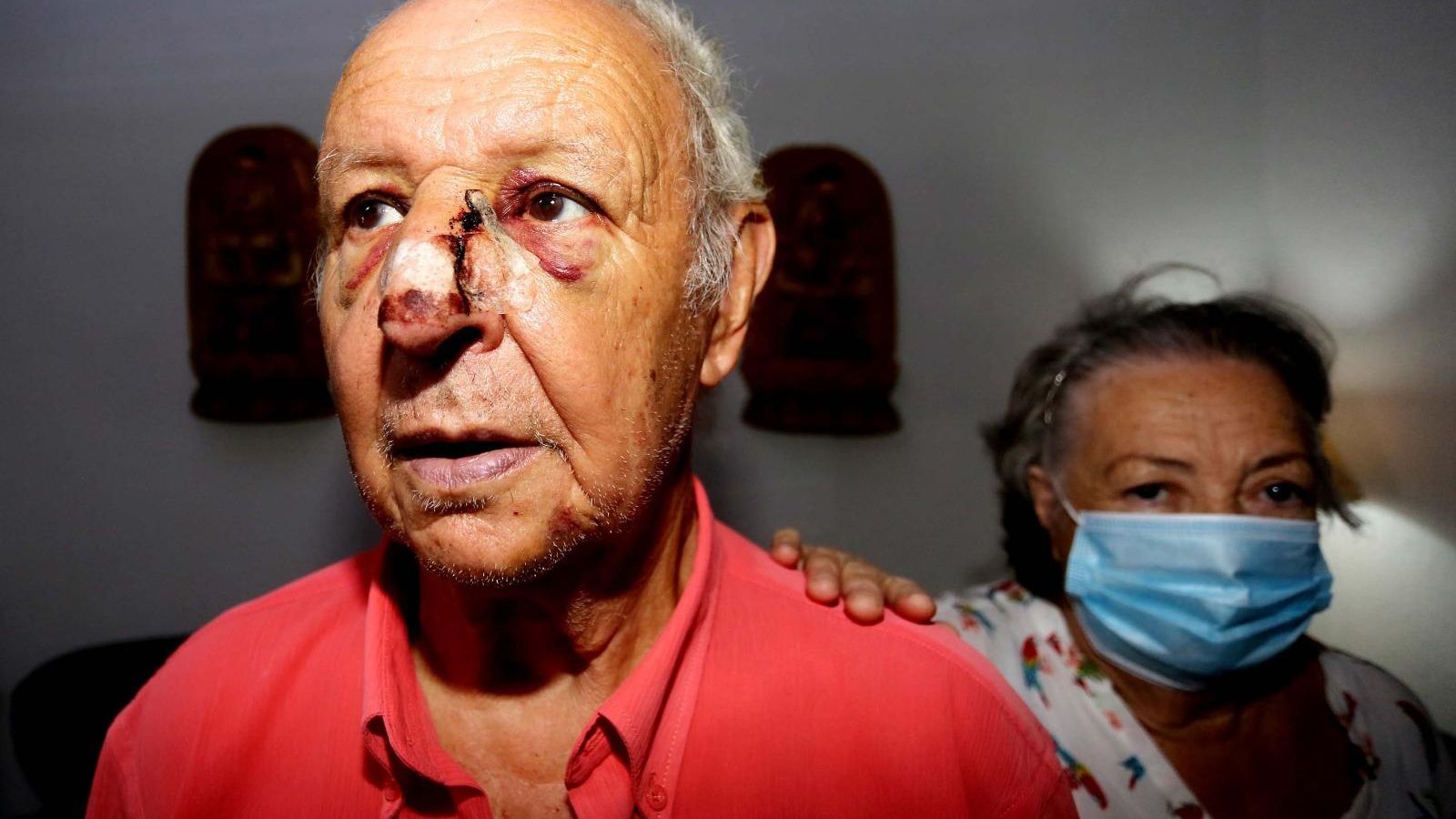 El anciano agredido junto a su esposa.