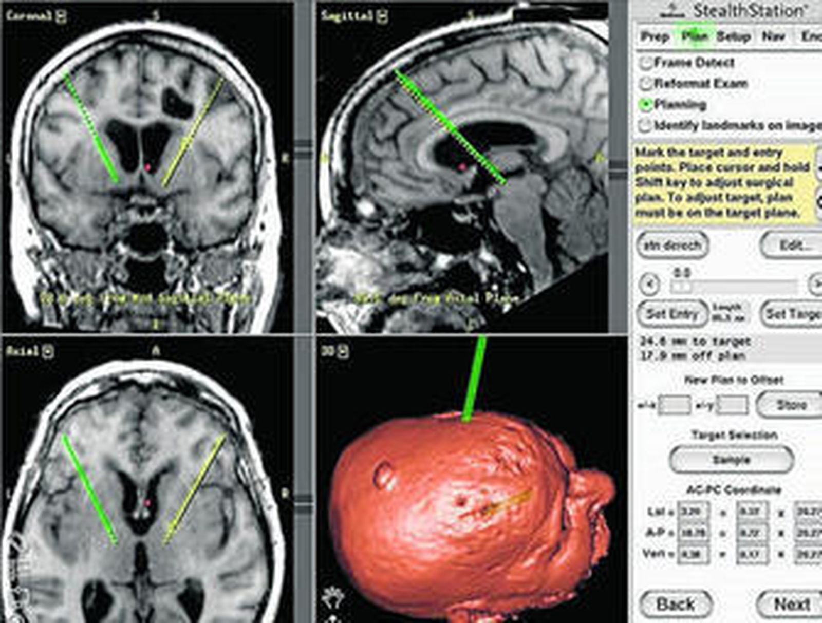 Los desafíos médicos frente al párkinson