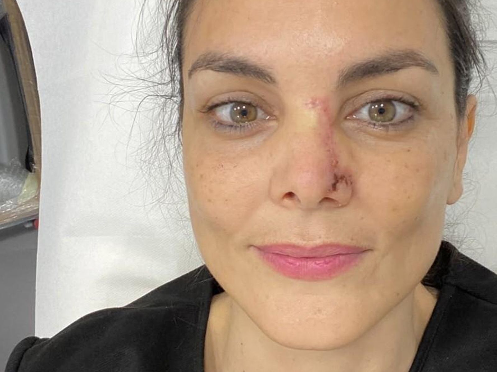 Monica Carrillo tras la intervención de su cáncer en 2020