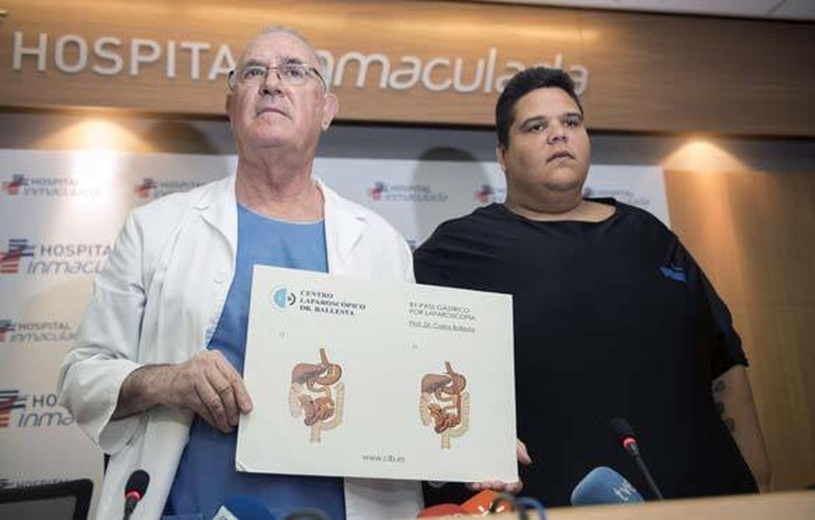 El hombre más obeso del país perderá 200 kilos tras un novedoso bypass gástrico