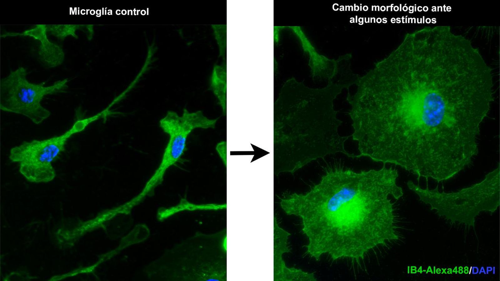 Cambios en la morfología de la microglía. En verde se marca la membrana celular y de azul los núcleos. Imágenes del laboratorio del grupo de Neurobiología celular.