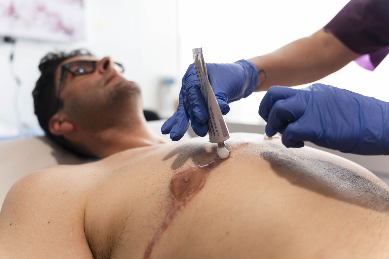 Un tratamiento de micropigmentación por mastectomía en un hombre, en imágenes