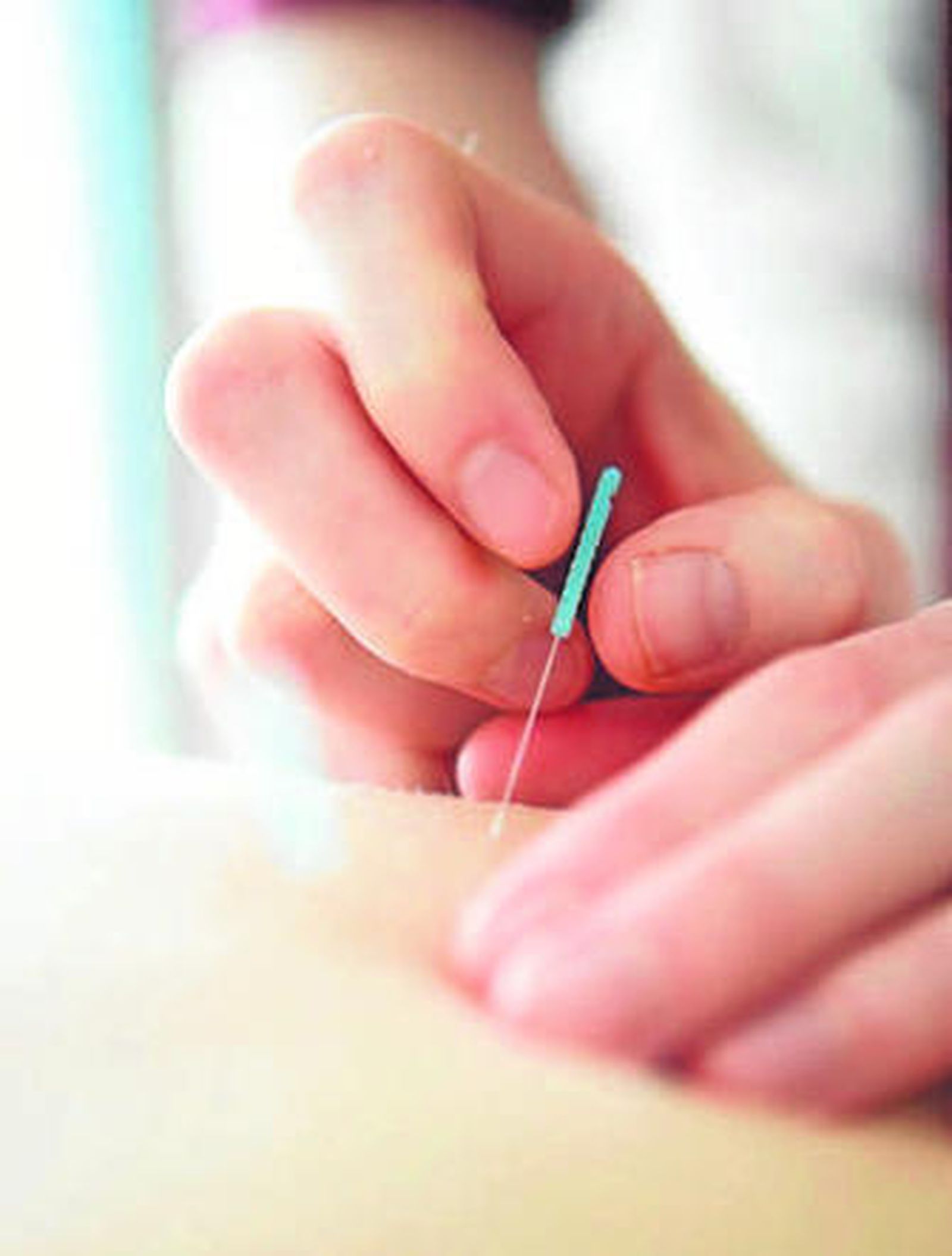 Técnicas tradicionales.