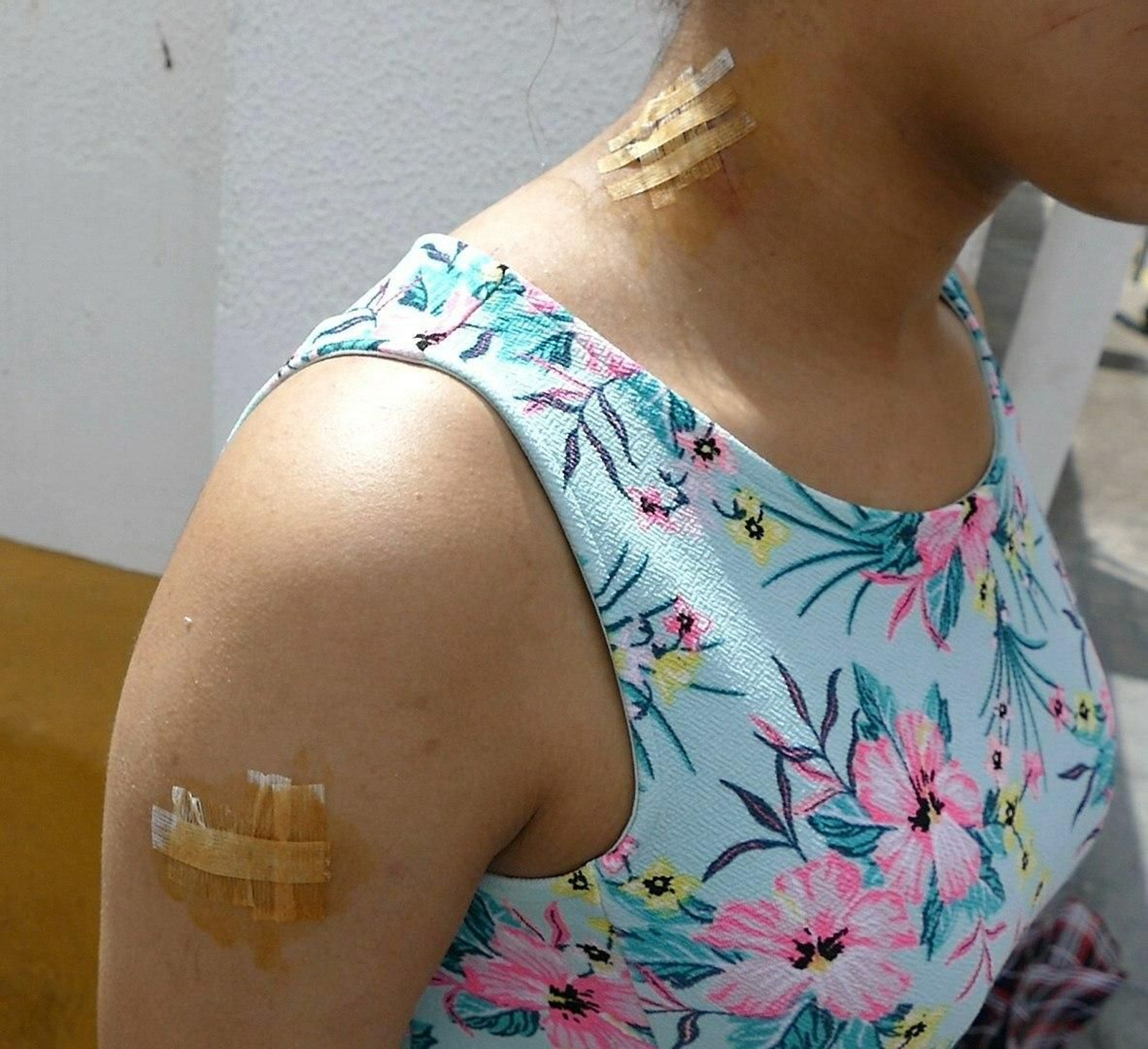 La menor muestra las heridas causadas por la agresión