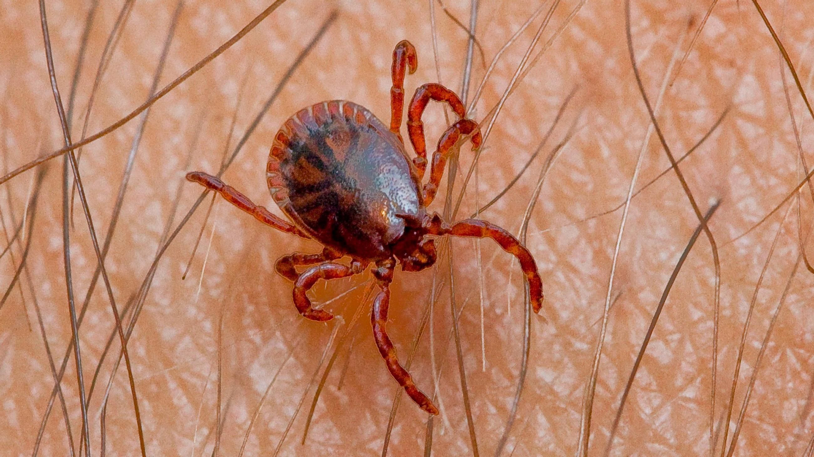 La fiebre Crimea-Congo suele ser fruto de la picadura de una garrapata.