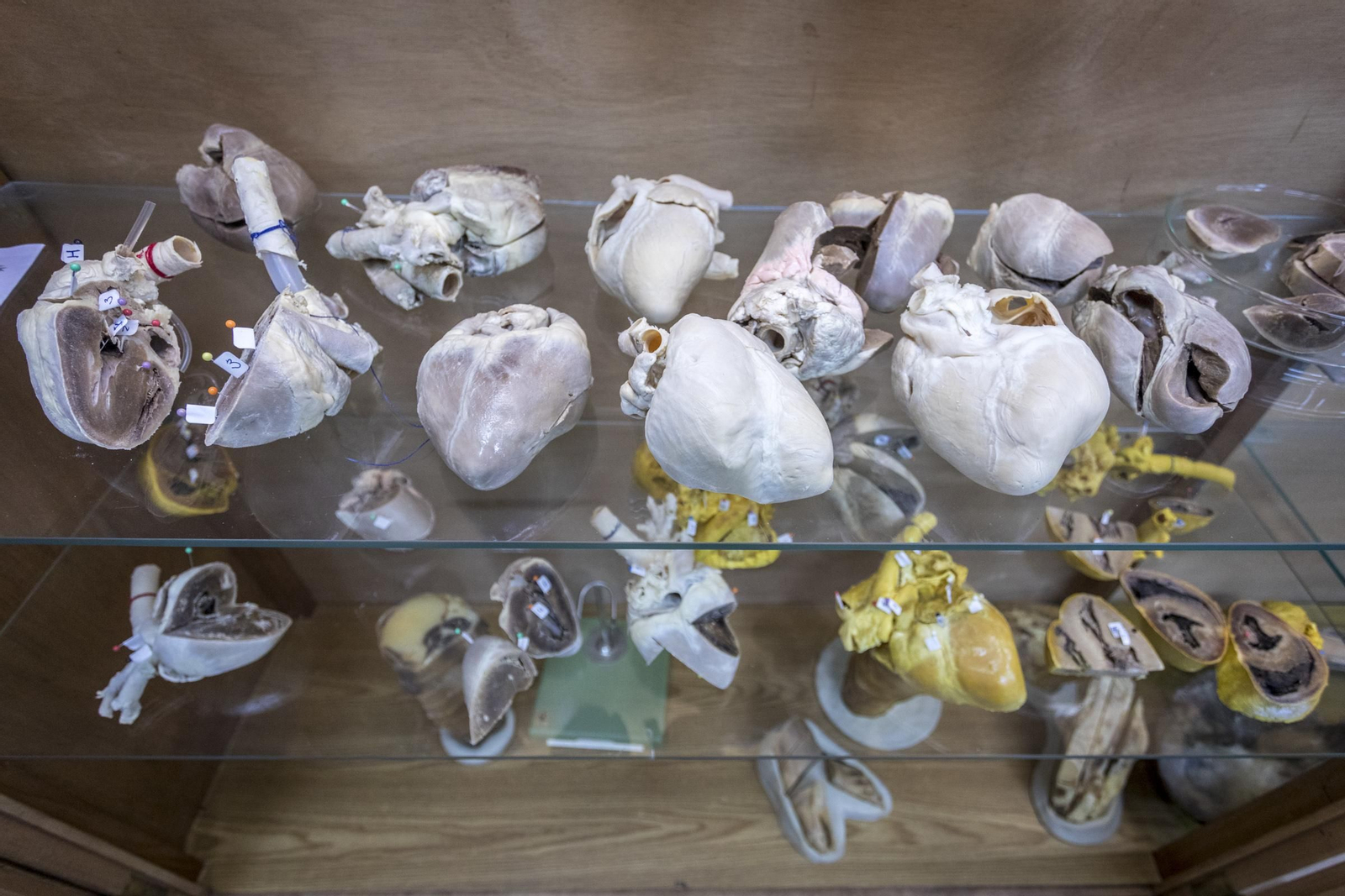 Corazones a los que se les ha aplicado la técnica de plastinación.