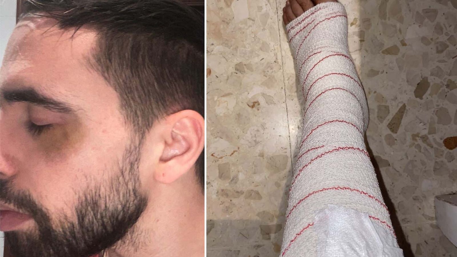 Imagen de las contusiones en la cara y en la pierna.