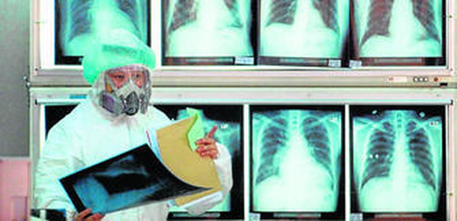 Un profesional trabaja con las antiguas placas de radiografías.