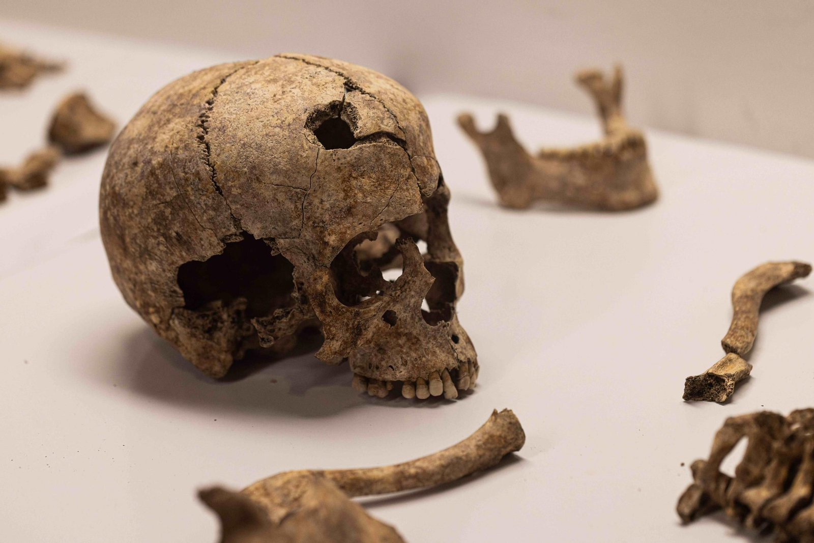 Estudio antropológico de los restos exhumados del Barranco de Víznar 3.