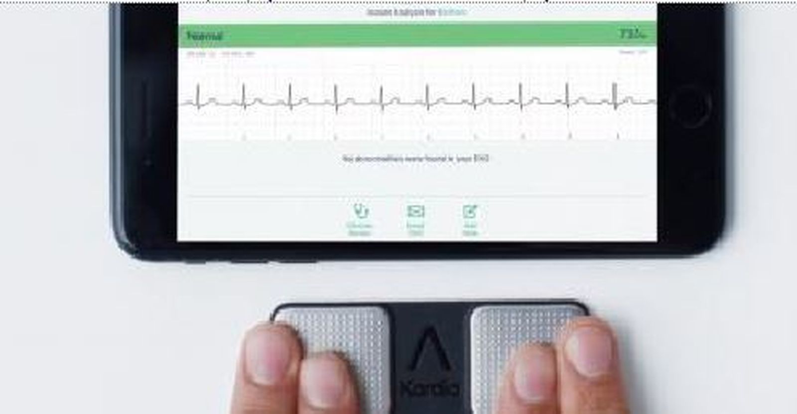 A diferencia de otros warebles, KardiaMobile permite remitir un informe al especialista de manera instantánea.
