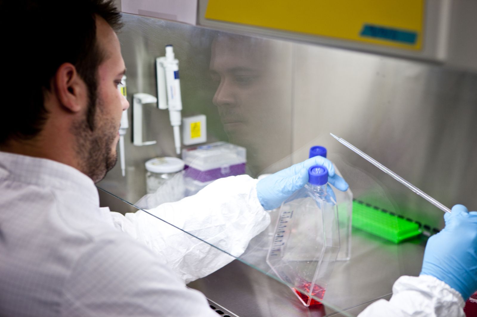 Los investigadores del centro Genyo participan en un proyecto sobre el Sindrome Sjogren