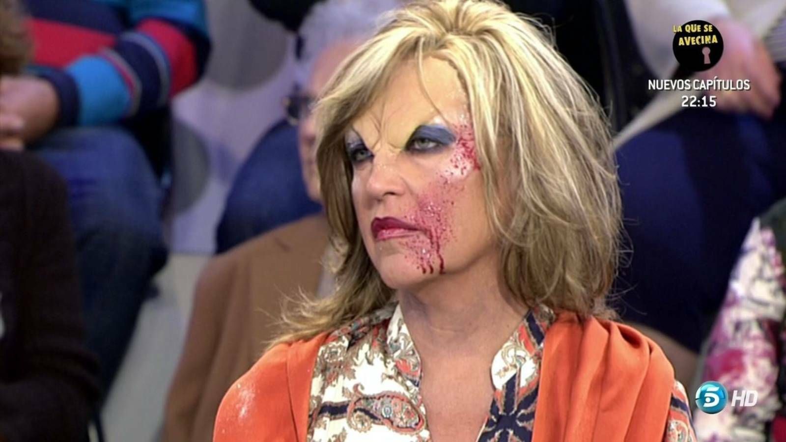 Lidya Lozano, caracterizada con una herida en Halloween.