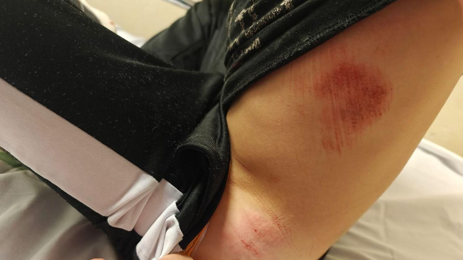 Algunas de las heridas que sufrió el menor