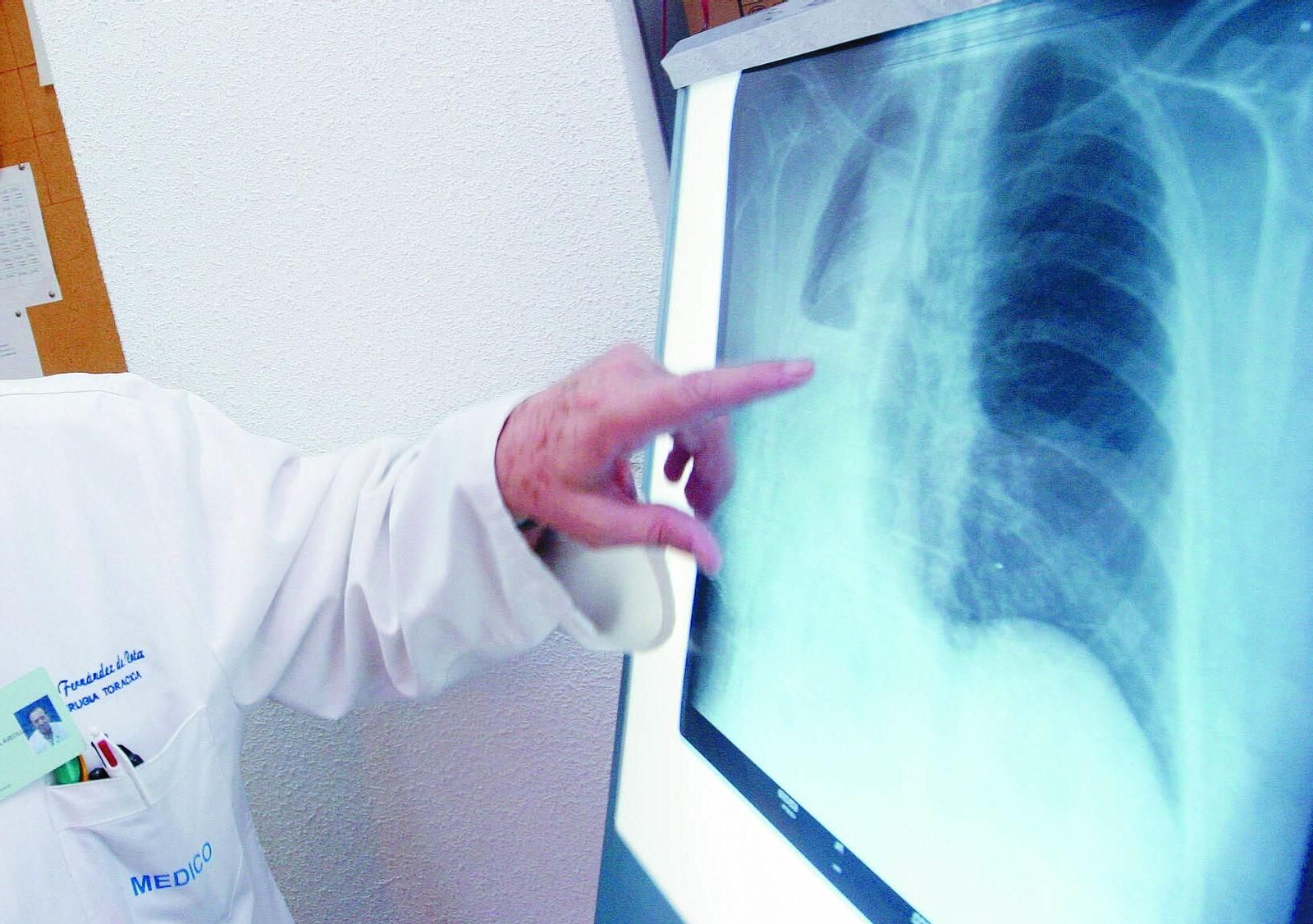 Un especialista revisa el estado de los pulmones de un paciente.