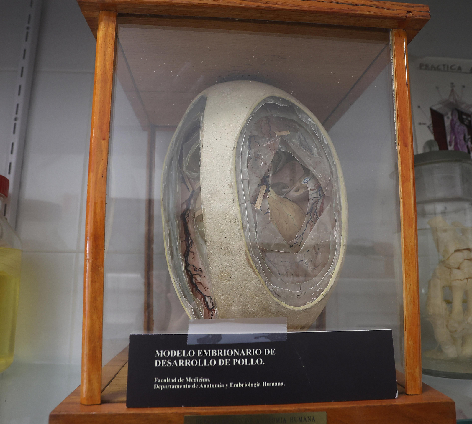 Restauración de esculturas anatómicas usadas con fines docentes entre el siglo XVIII y el XX en la Facultad de Medicina de la US