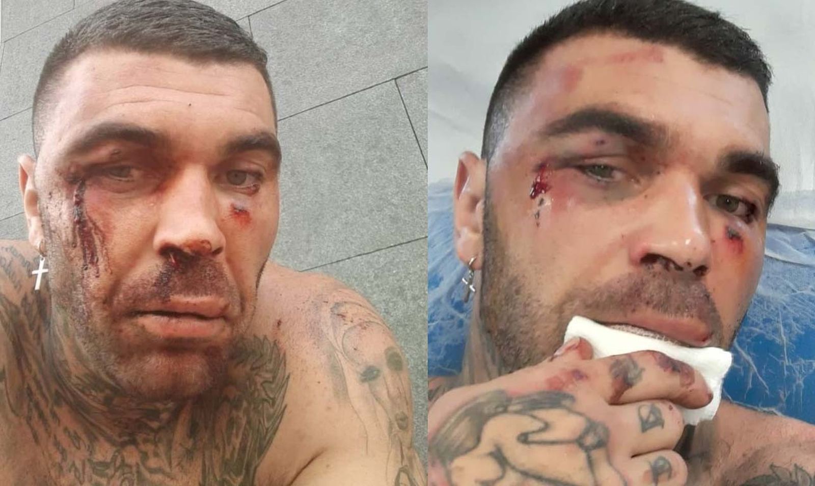 Estado del ultra neonazi del Betis Manuel Herrera, tras la paliza