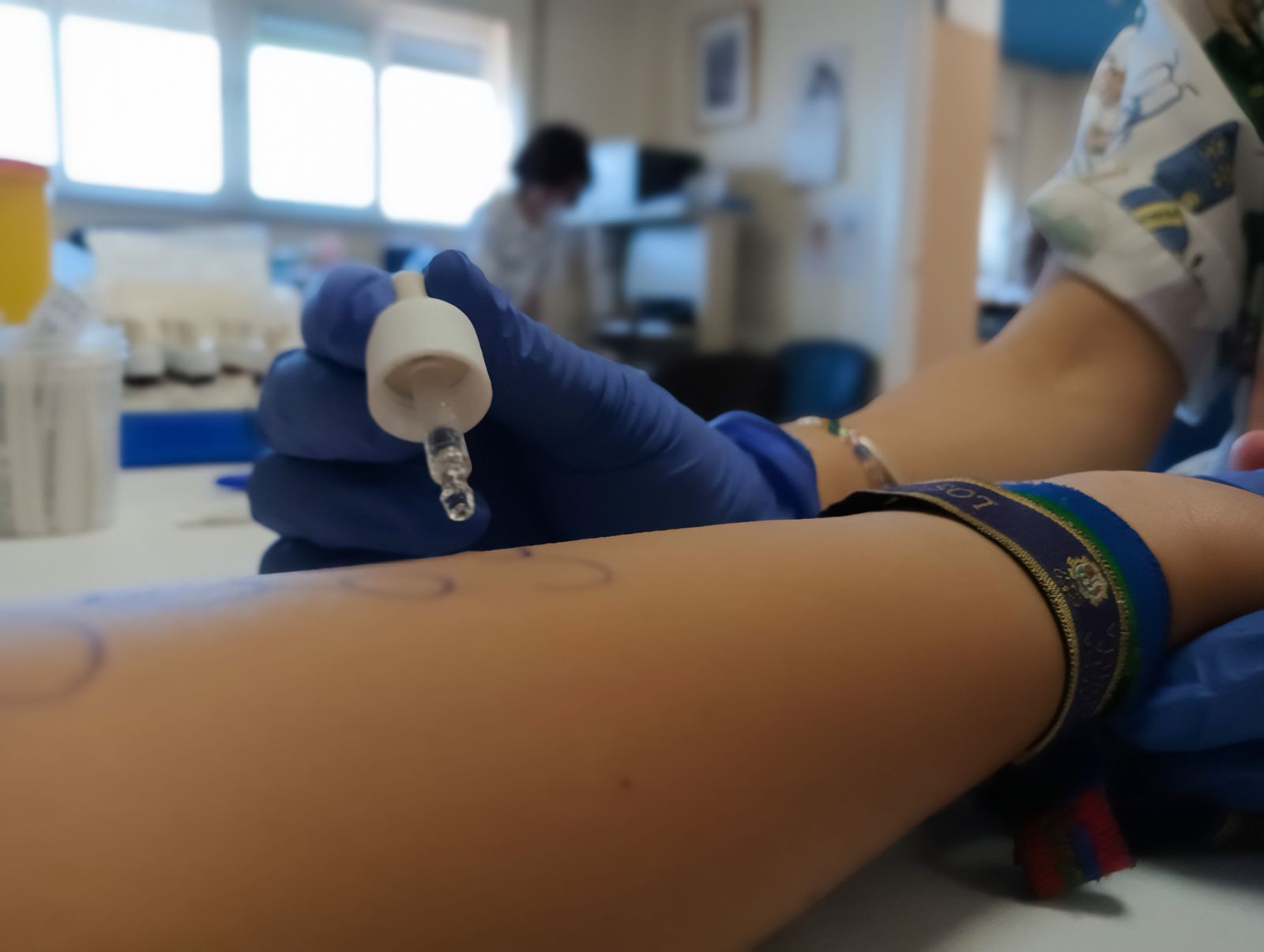 Test cutáneo de alérgenos a paciente pediátrica.