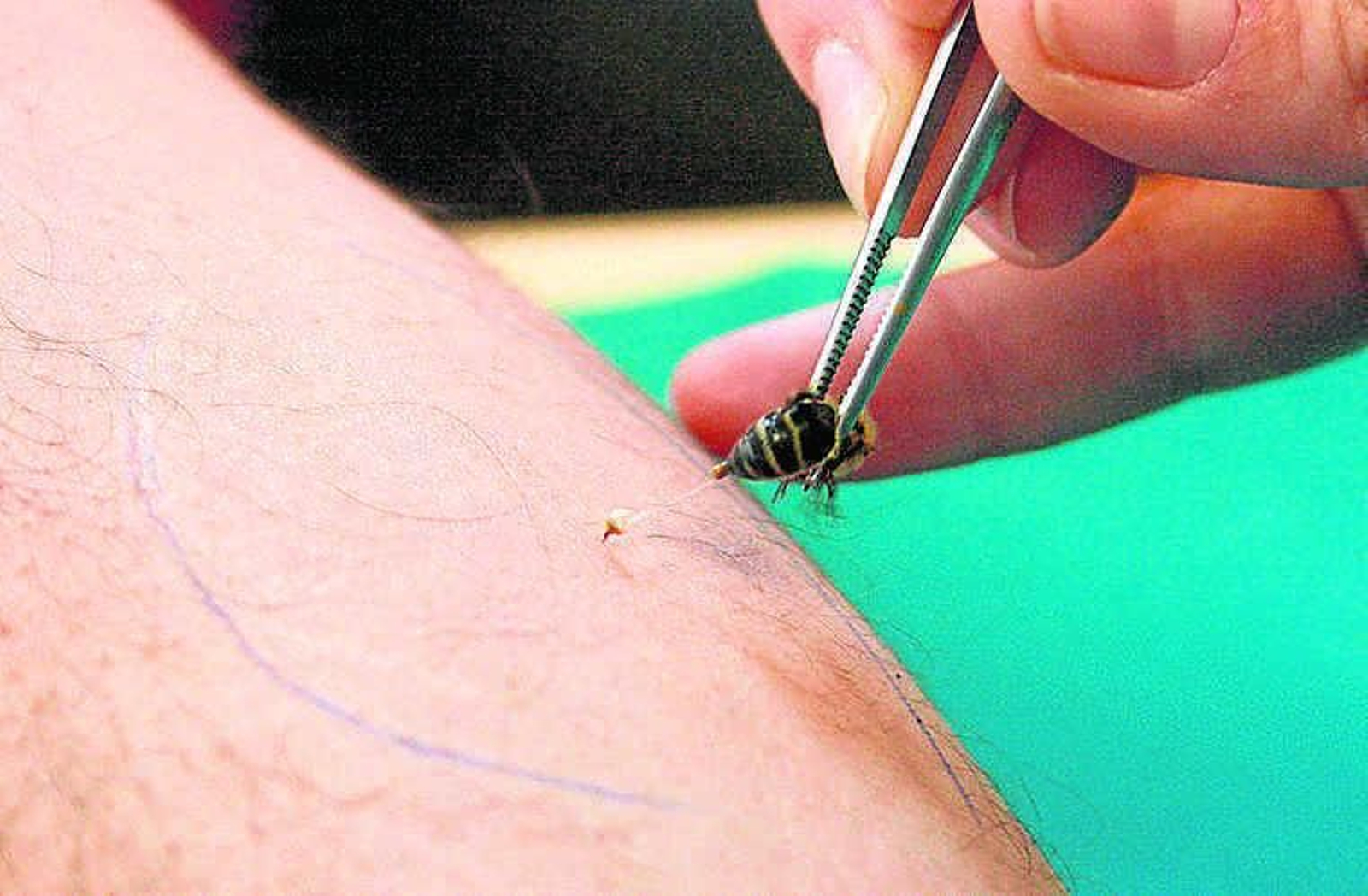 Prueba de alergia a las avispas y abejas.