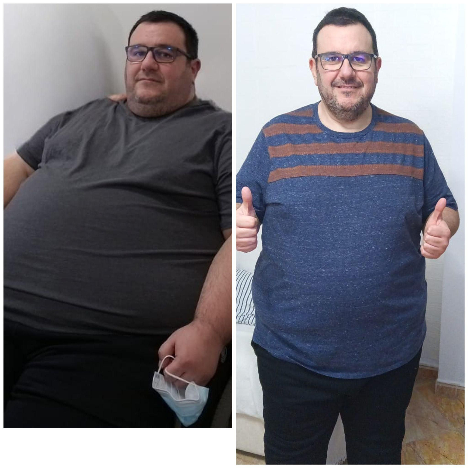 Eduardo antes y después de ser operado de obesidad Eduardo antes y después de ser operado de obesidad