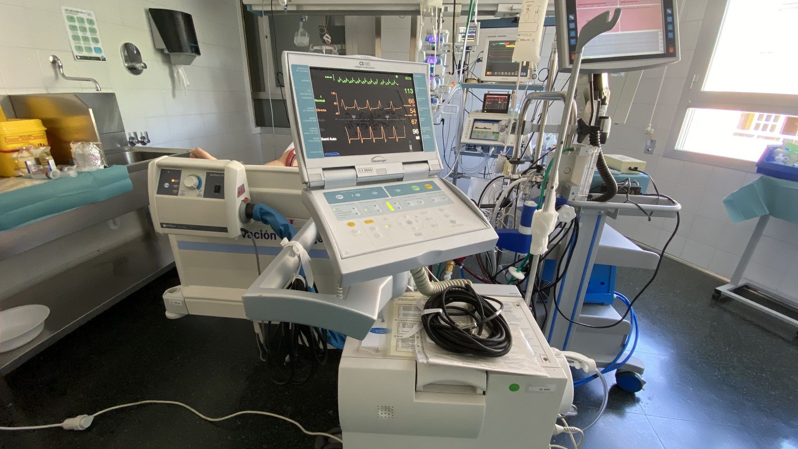 La ECMO conectada a un paciente de la UCI del Hospital Regional de Málaga.