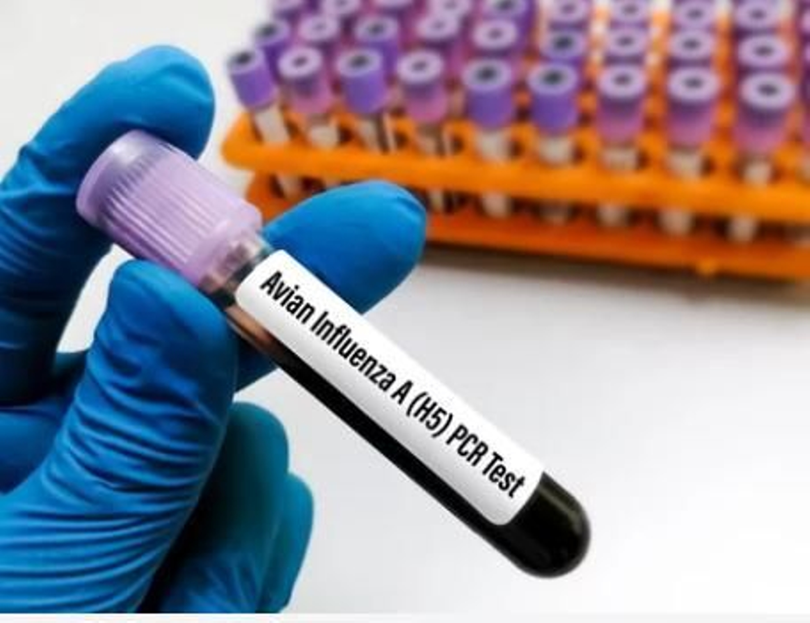 Comienzan las pruebas de la vacuna de la gripe aviar en humanos: ¿Podrían evitar una posible pandemia?