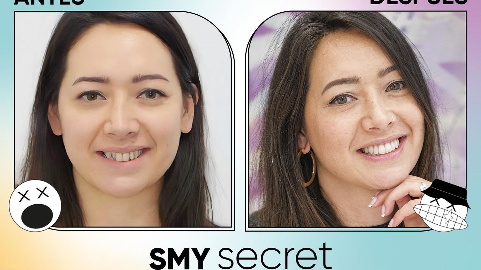 Ortodoncia Invisible