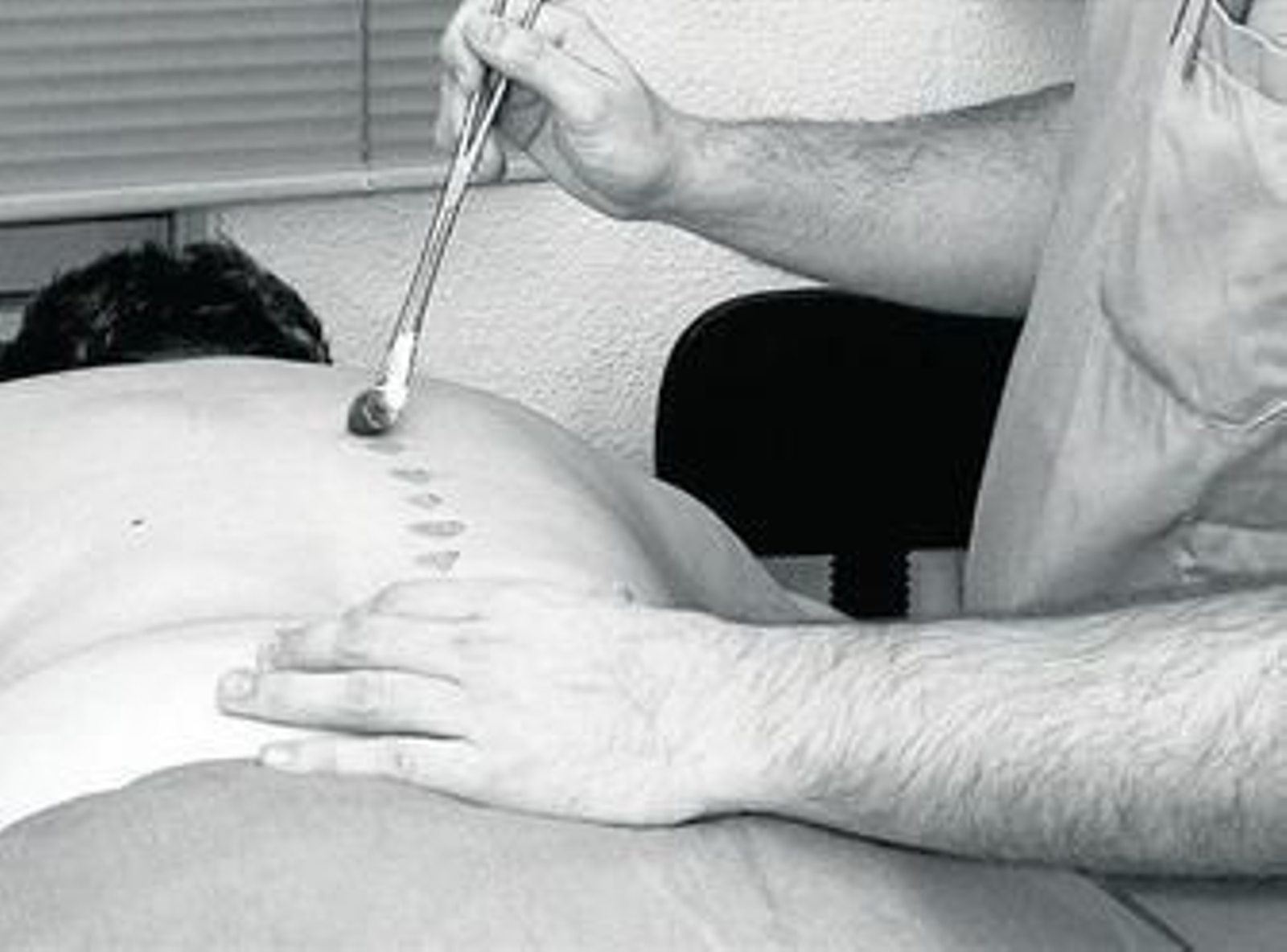 Ozonoterapia para un paciente.