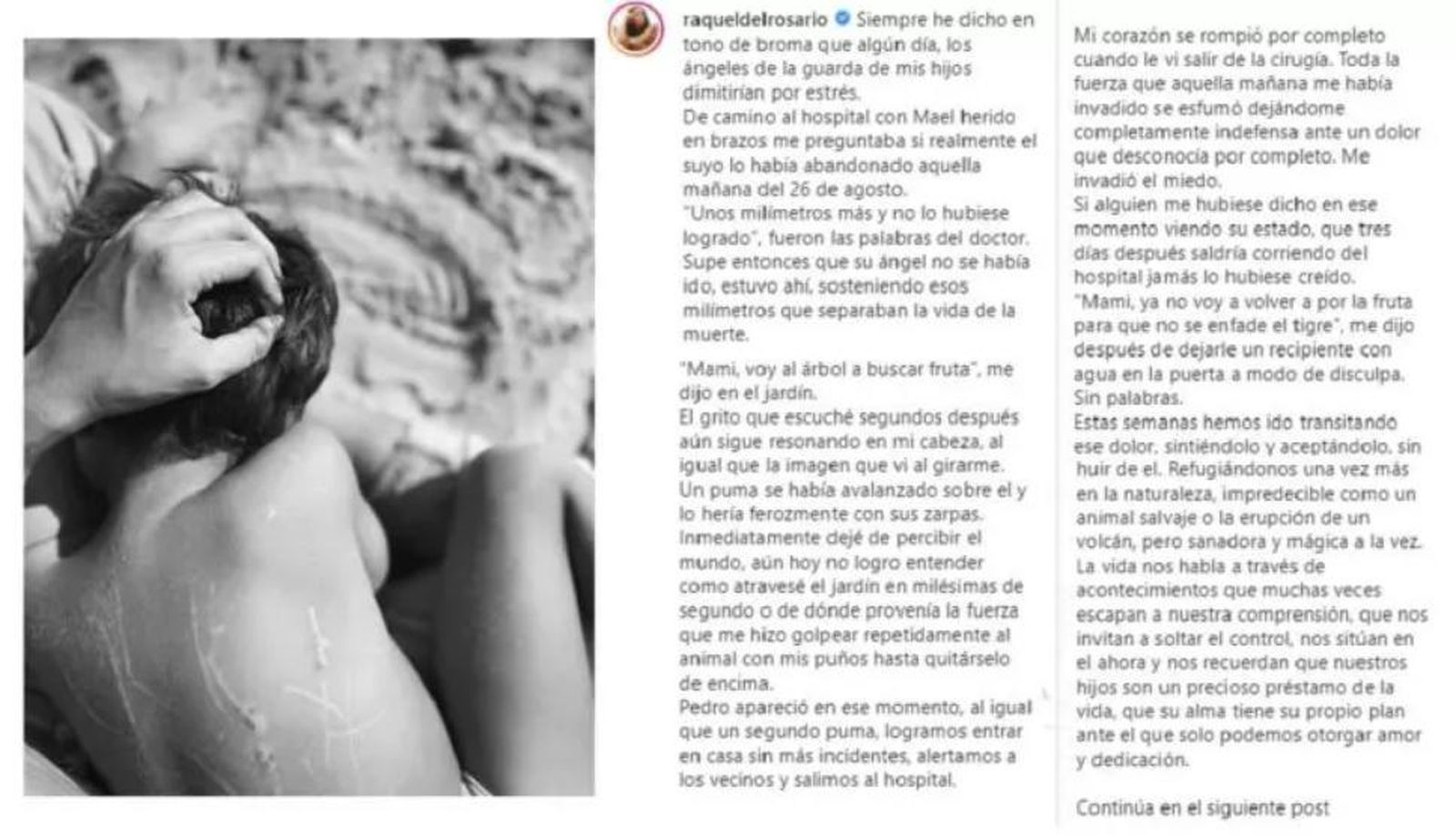 Raquel del Rosario salva a su hijo del ataque de un puma