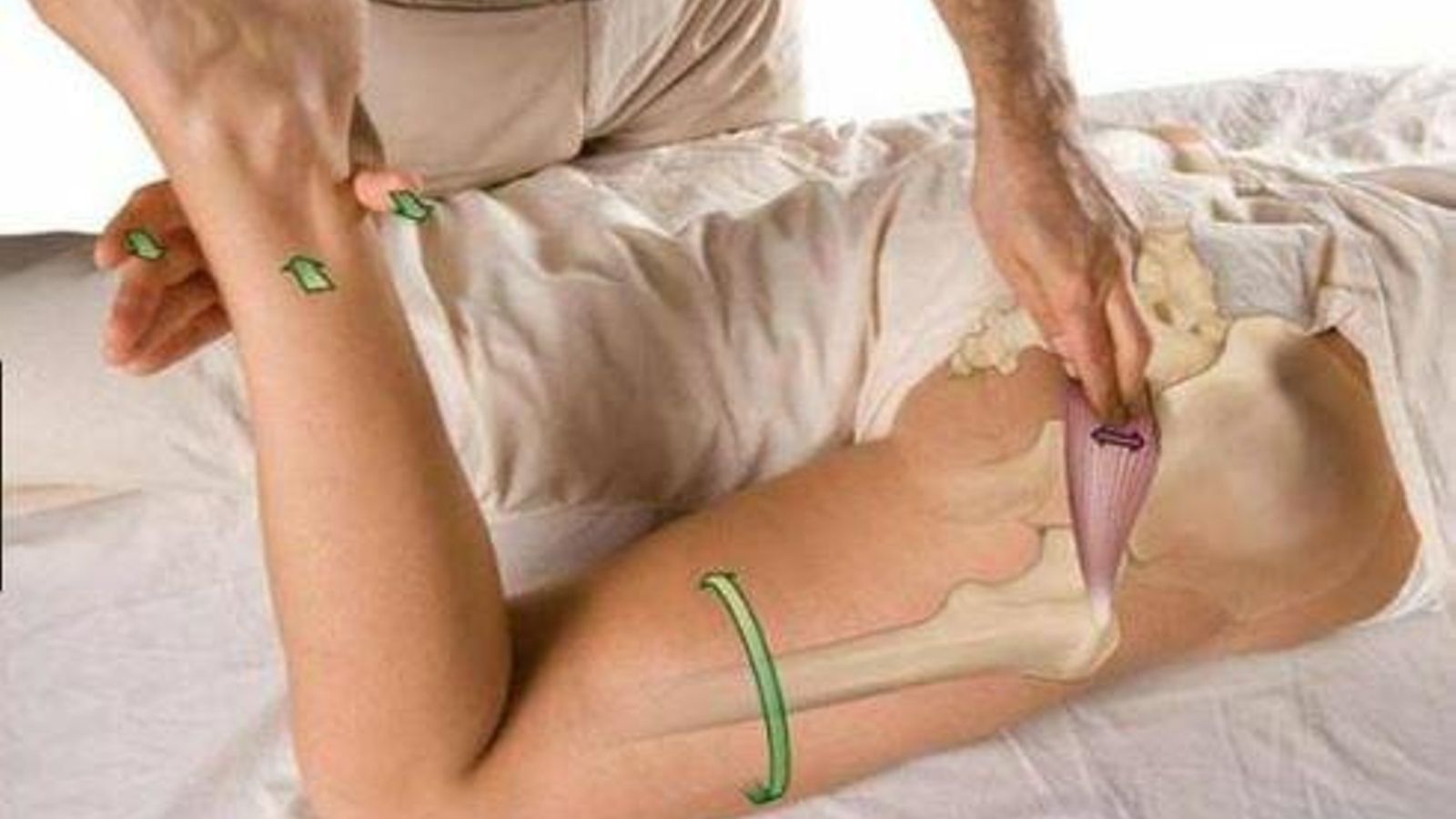 Tratamiento de fisioterapia del piramidal