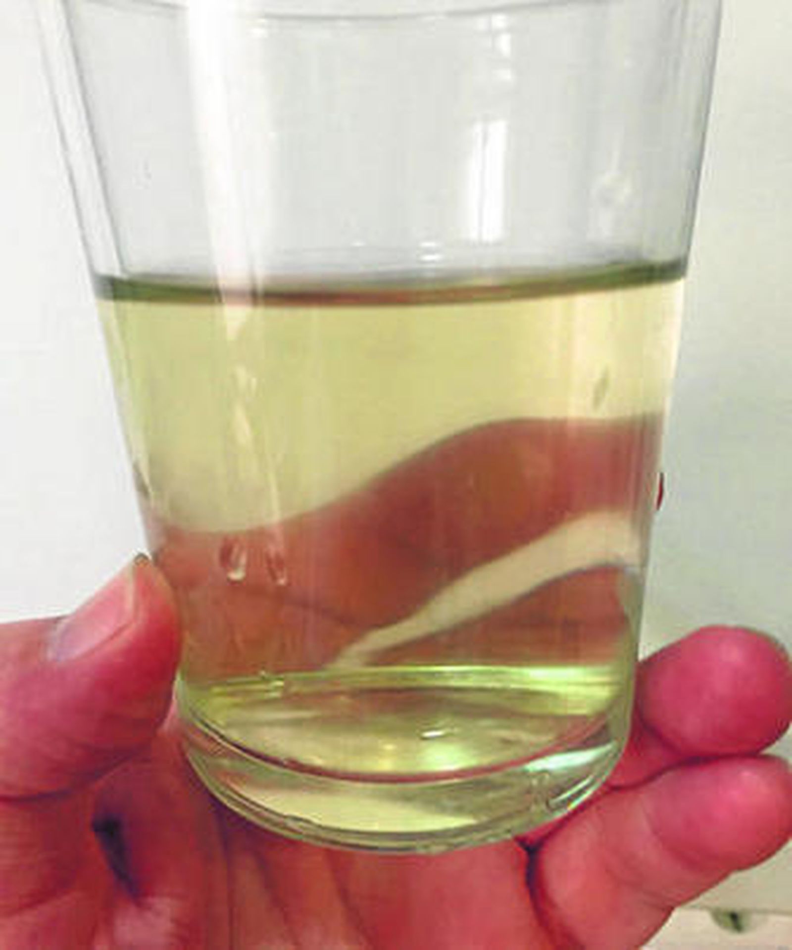 El agua salía amarilla de los grifos de los afectados, ayer.