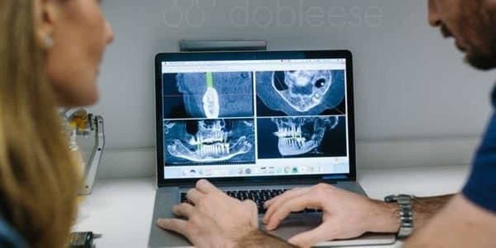 Implantes dentales proceso paso a paso